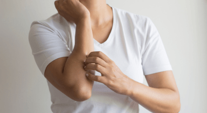 Dermatologie En Jeuk